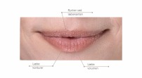 Fillerina® 12HA Specific Zones Lips & Mouth - Grad 5, filler uden injektion